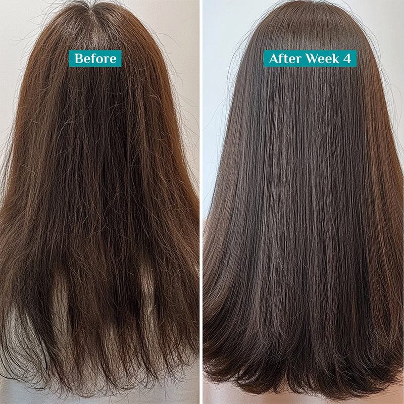 Rosemary & Biotin Anti-Hairfall Shampoo