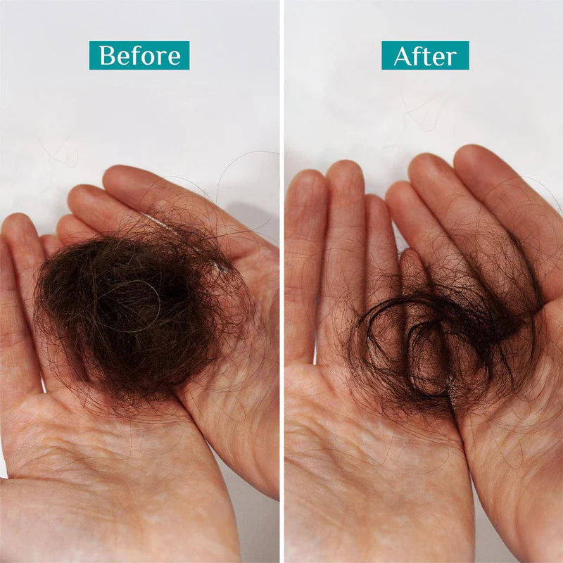 Rosemary & Biotin Anti-Hairfall Shampoo