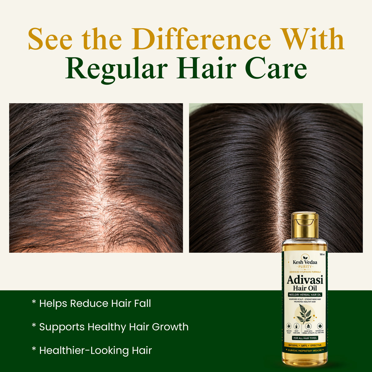 Kesh Vedaa Adivasi Hair Oil – Ayurvedic Herbal Hair Oil for Hair Fall & Scalp Care