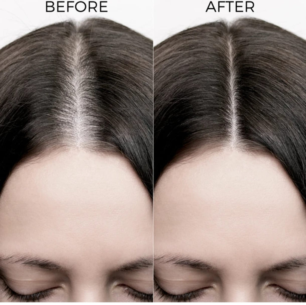 Onion Hair Oil with Onion Oil & Redensyl for Hair Fall Control - 250 ml