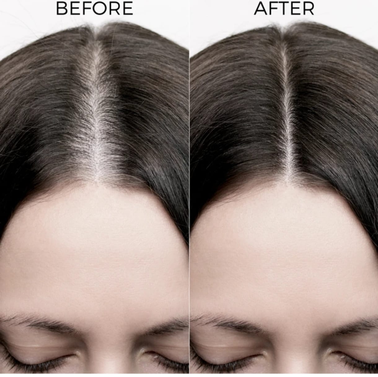 Onion Hair Oil with Onion Oil & Redensyl for Hair Fall Control - 250 ml